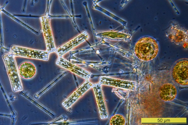Planktische Algen (Ceratium, Scenedesmus, Pediastrum)