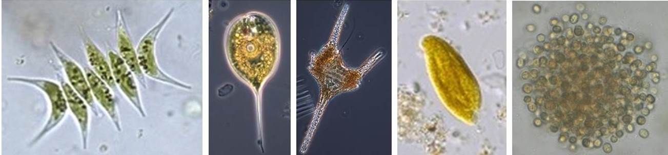 Mikroskopische Aufnahmen 5 verschiedener Phytoplanktonarten in ihrer faszinierenden Vielfalt in Form und Farbe