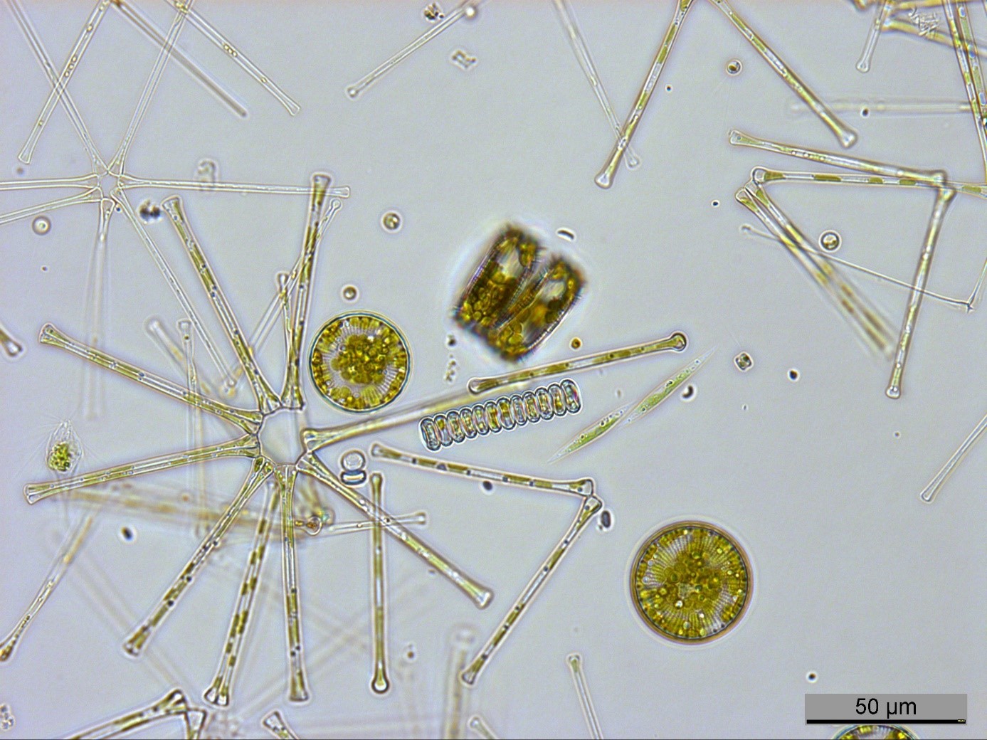 Mikroskopaufnahme von Phytoplankton im Bodensee