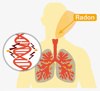 Die Abbildung zeigt eine stilisierte Person, die Radon einatmet. Das eingeatmete Radon kann sich in der Lunge ansammeln und durch seine Strahlung das Erbgut schädigen. Dies kann langfristig Lungenkrebs verursachen.