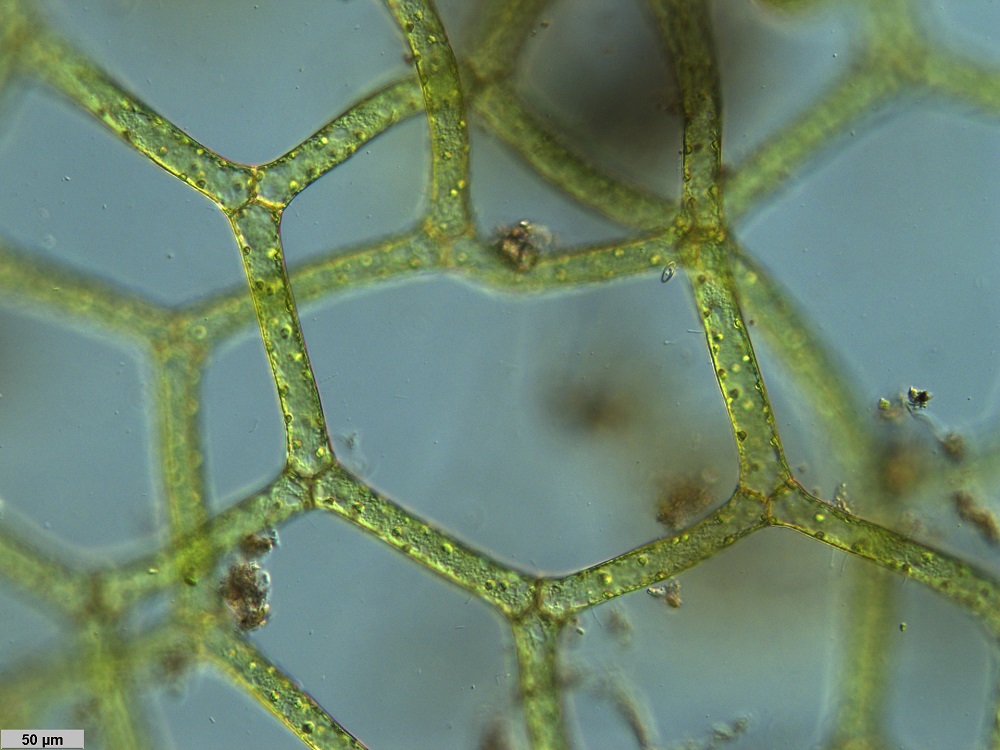 Wassernetz-Alge in der Mikroskopansicht. Quelle: LUBW